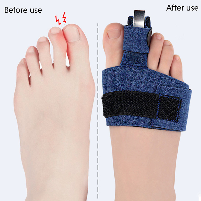 1 Adet Ayak Parmağı Düzeltici, - Ankle Brace Sock incelemesi ve fiyatı